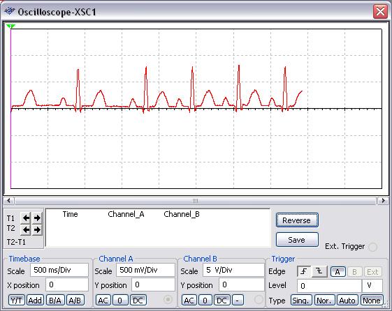 Biomedical Application Multisim Simulation With An Ecg Amplifier