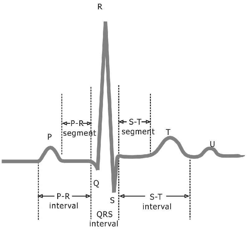 Normal Electrocardiogram